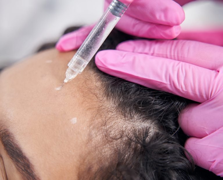 Female is on the procedure of professional facial mesotherapy to improve skin condition